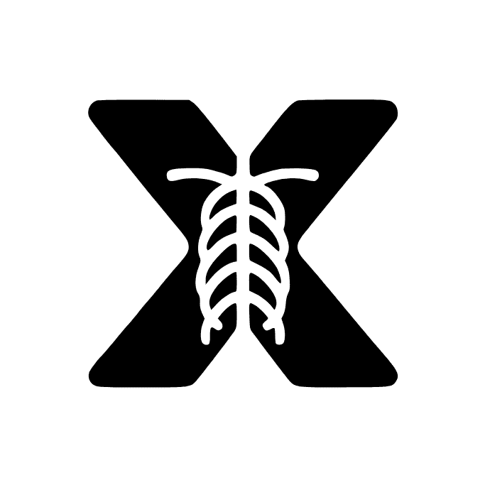 X-ray Interpreter